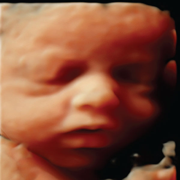 HD Ultrasound
